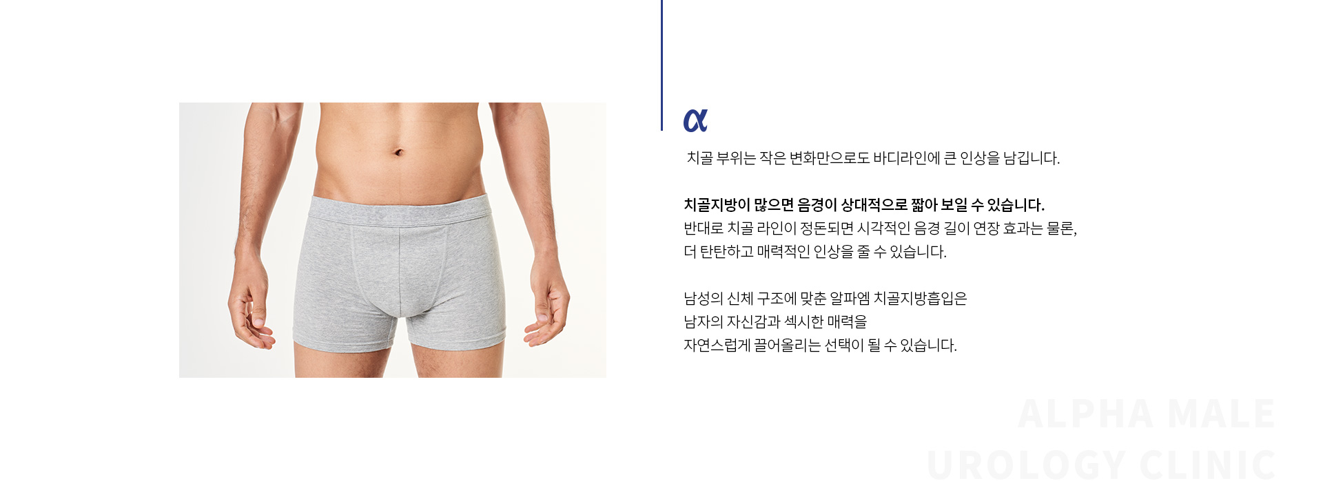 남성 체형 성형 02