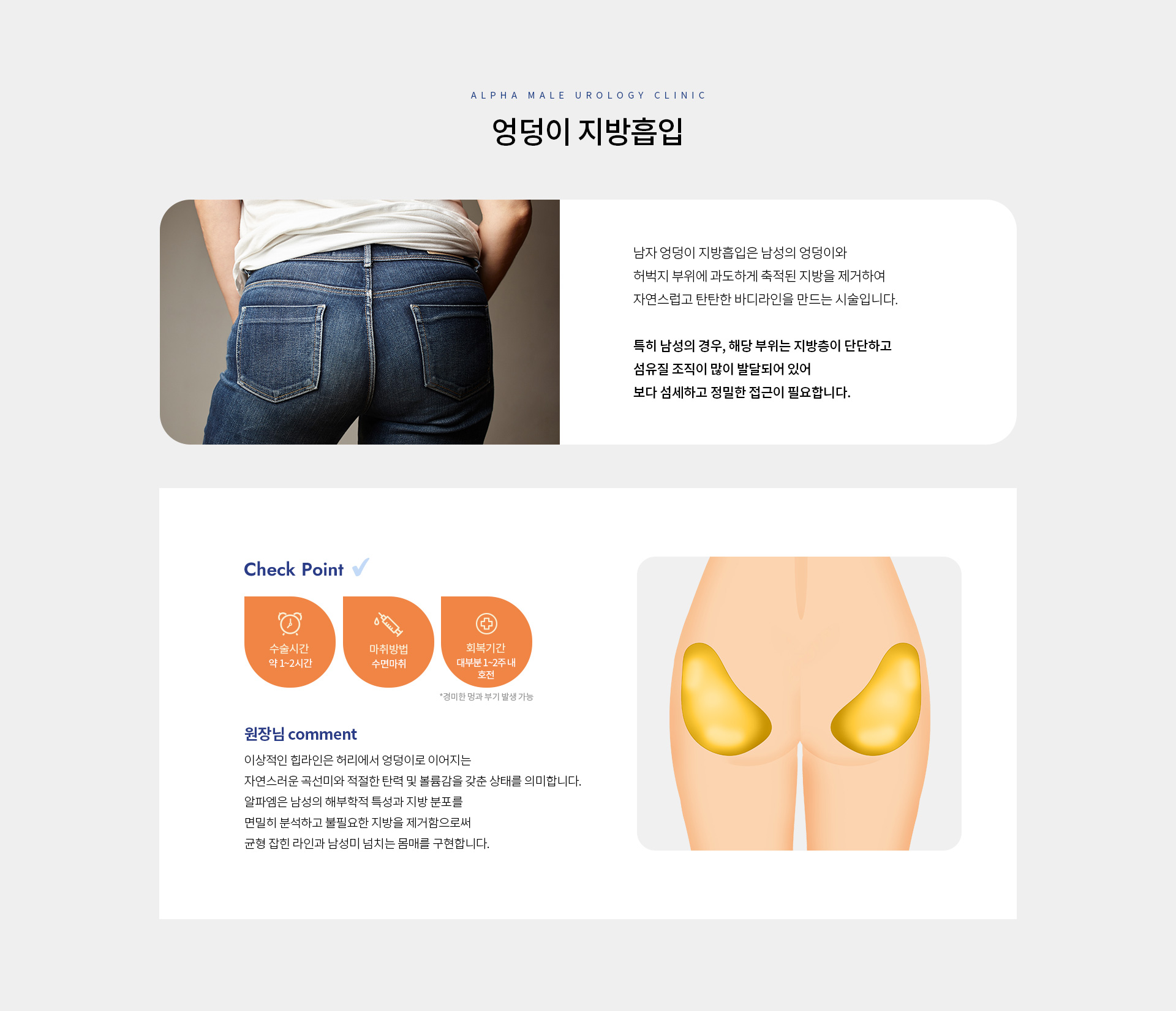 남성 체형 성형 06