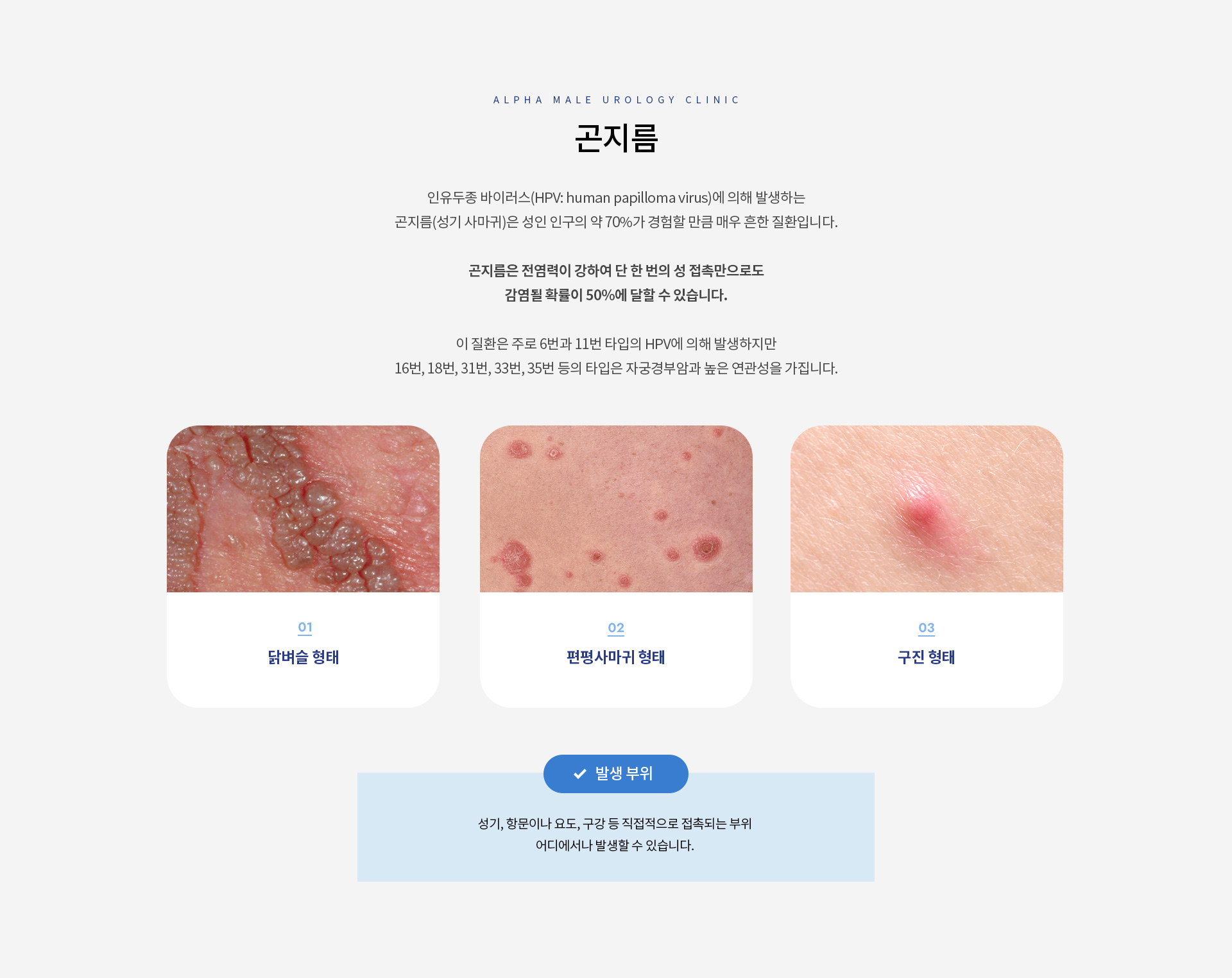곤지름제거가다실 03