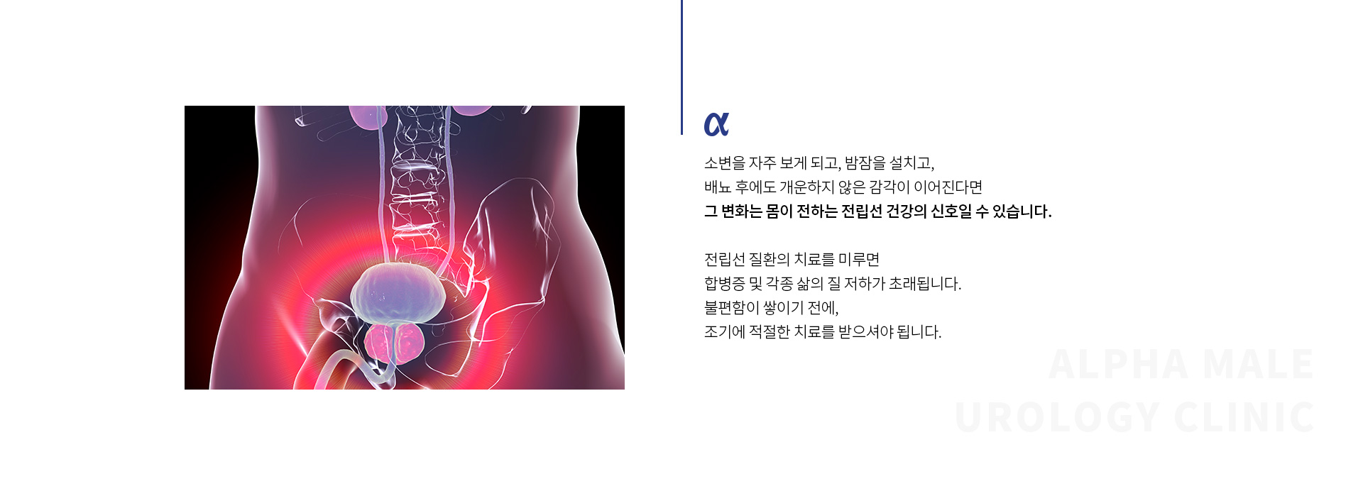 전립선비대증전립선염 02