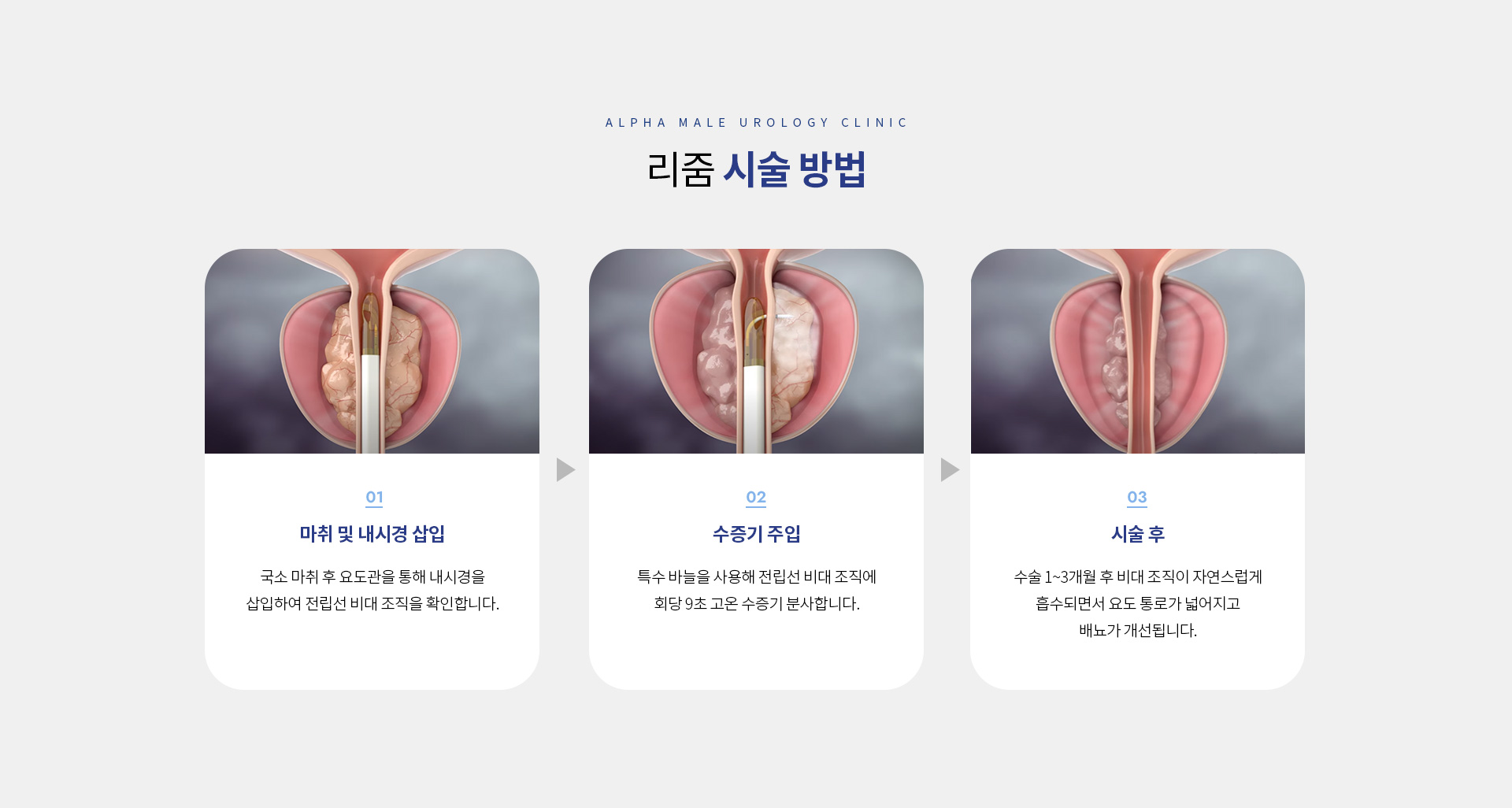 전립선비대증전립선염 08