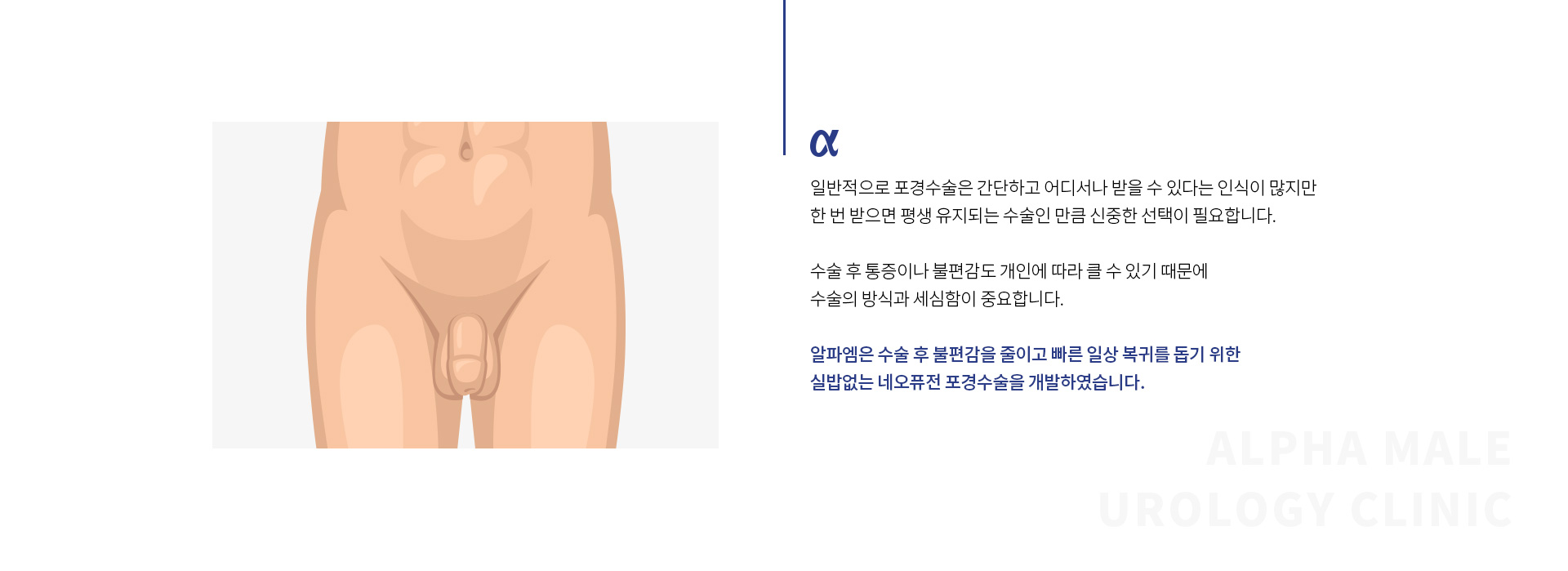 실밥없는포경수술 02