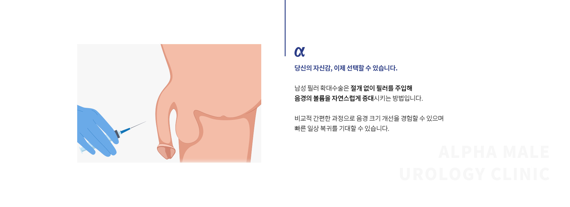 남성필러확대수술 02