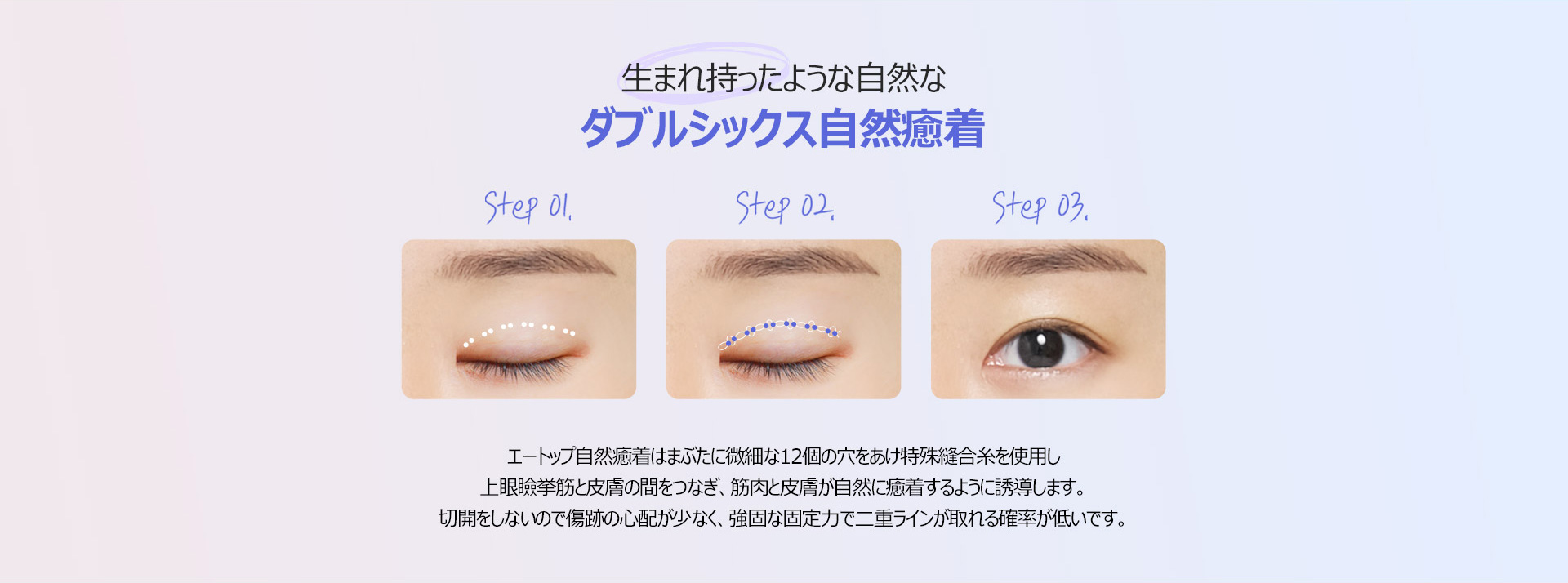 핏미 자연유착