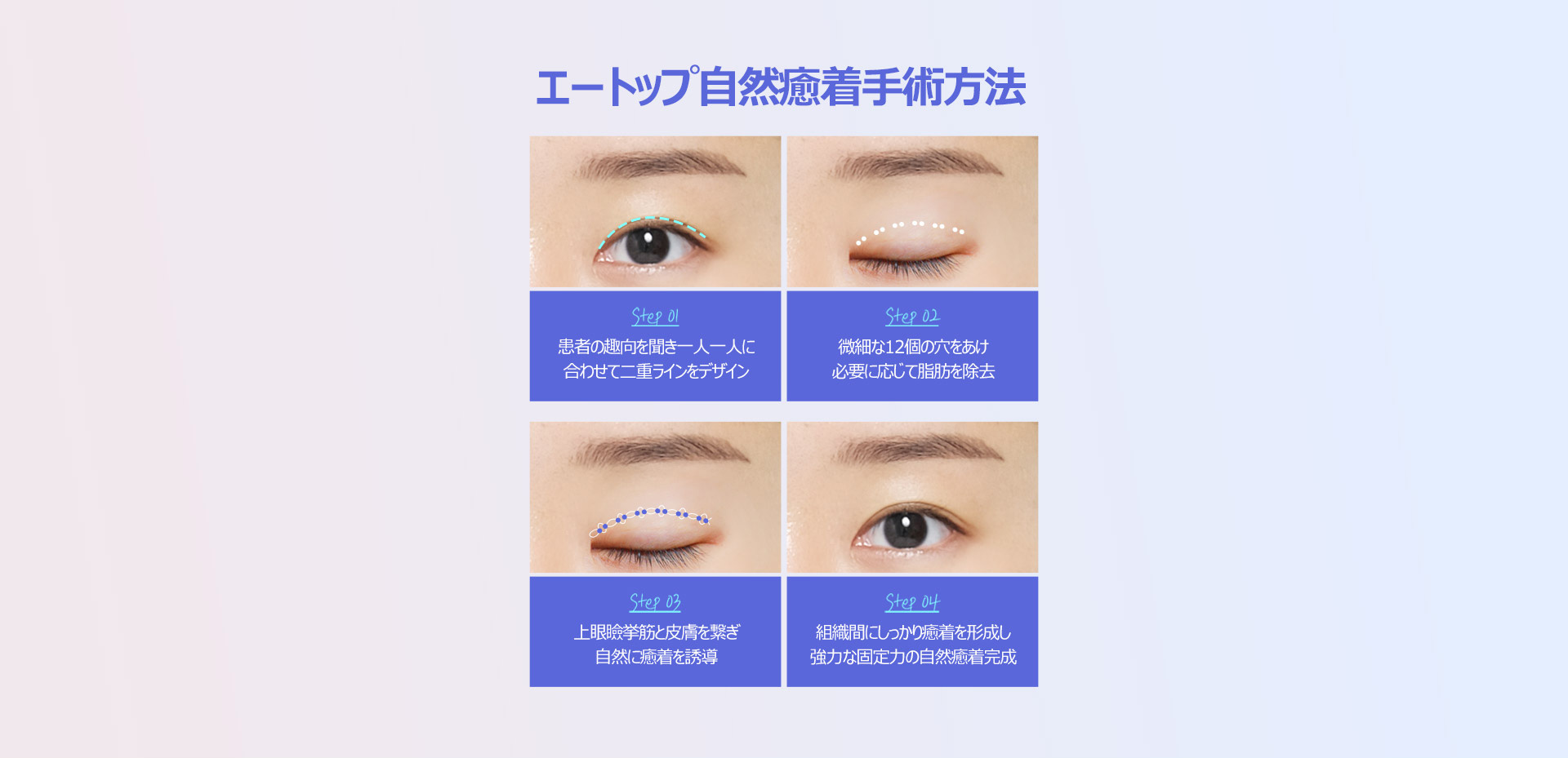 핏미 자연유착
