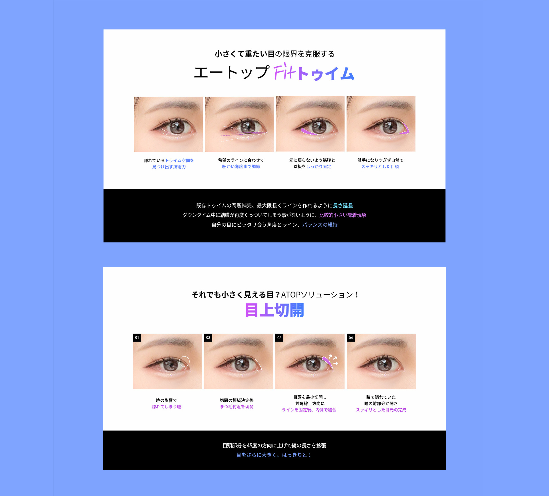 FIT트임