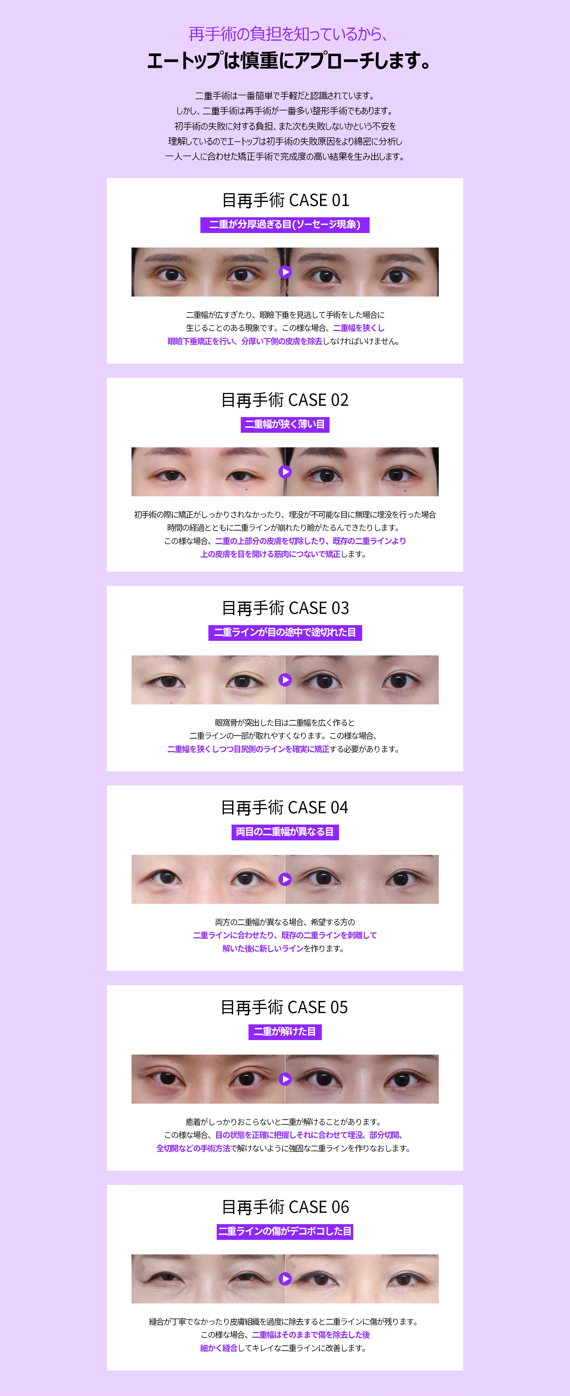 눈재수술