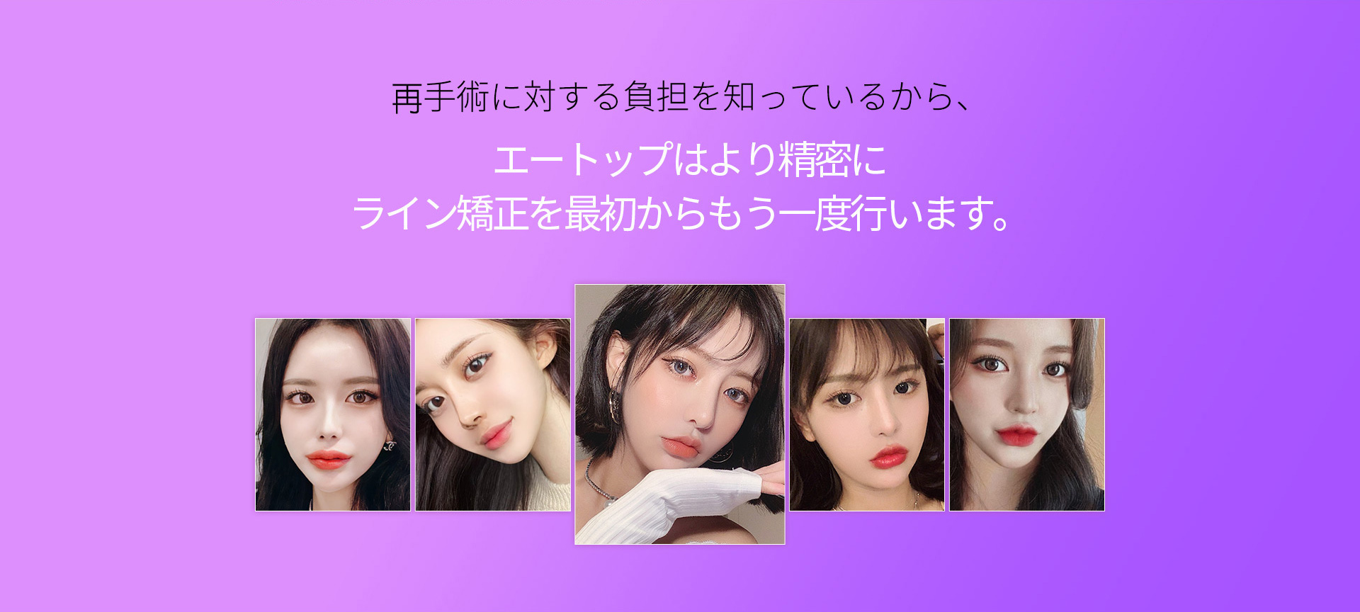 눈재수술