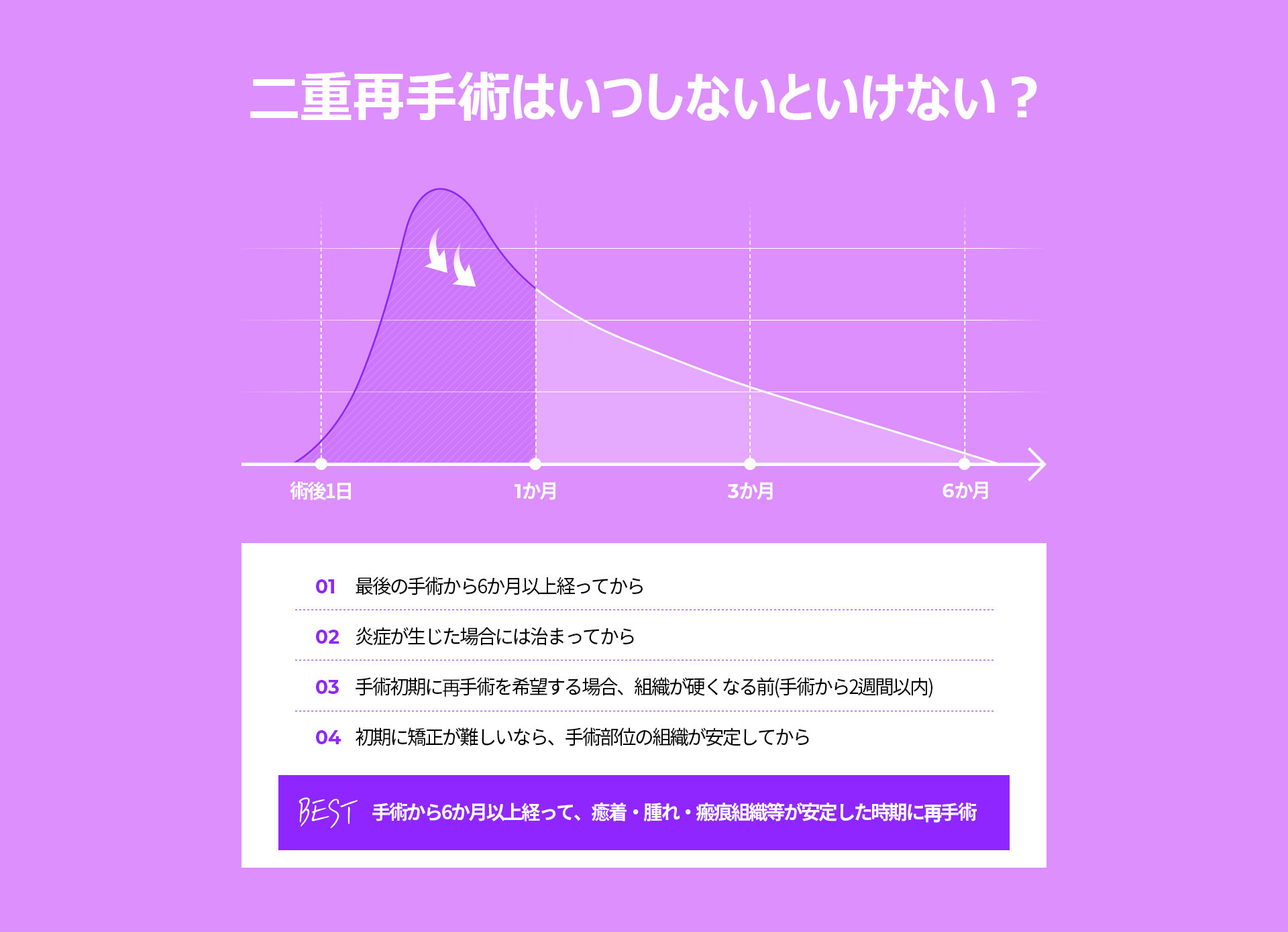 눈재수술