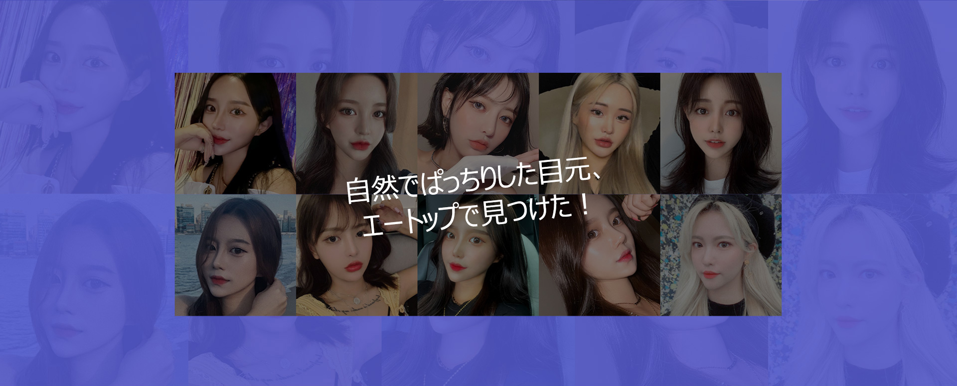 히든스카절개눈성형