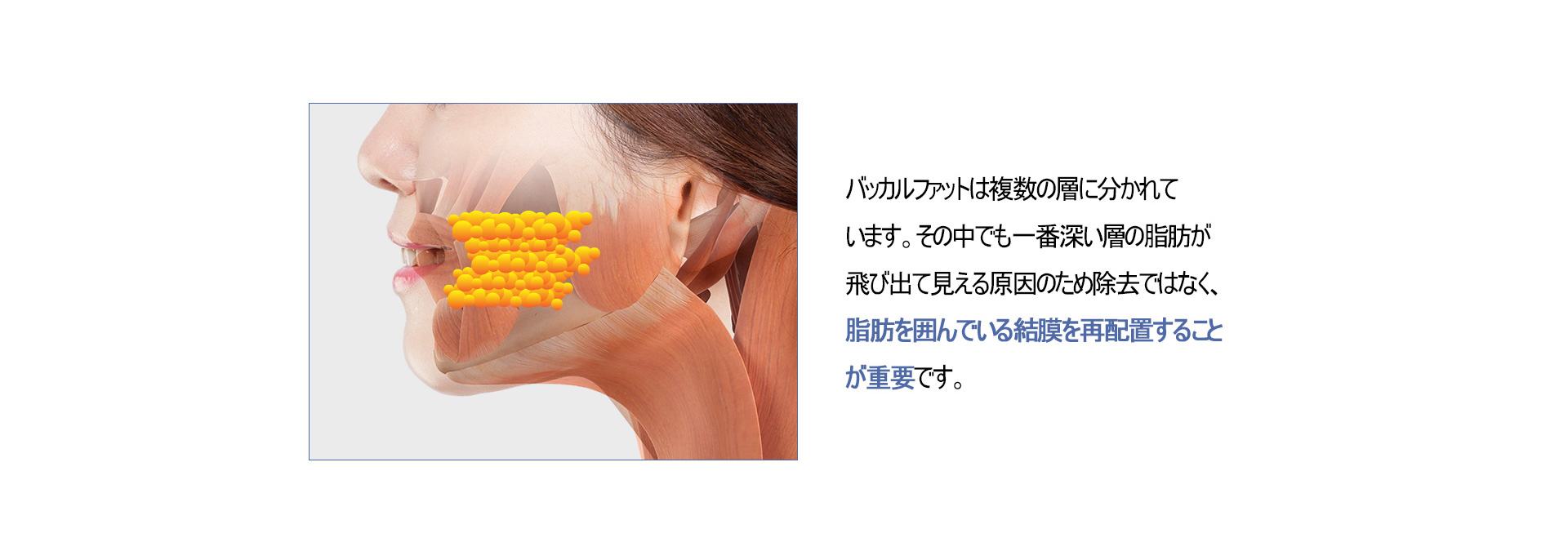 심부볼 지방 재배치