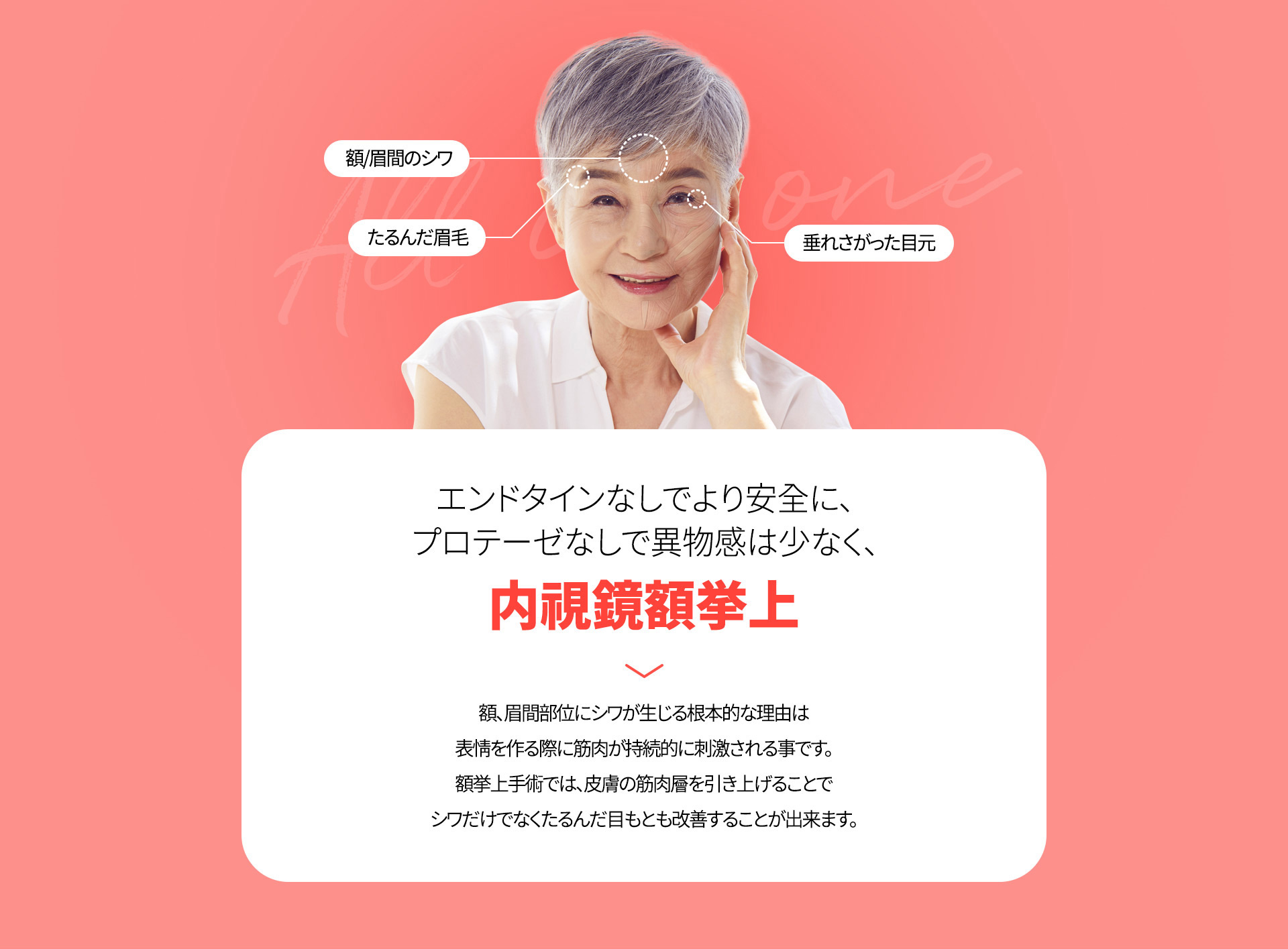 내시경 이마거상