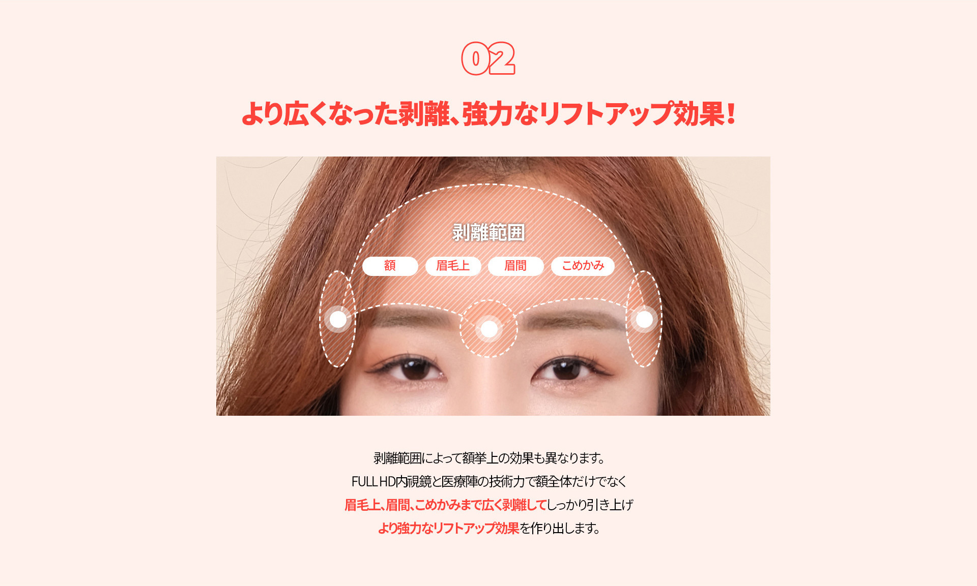 내시경 이마거상