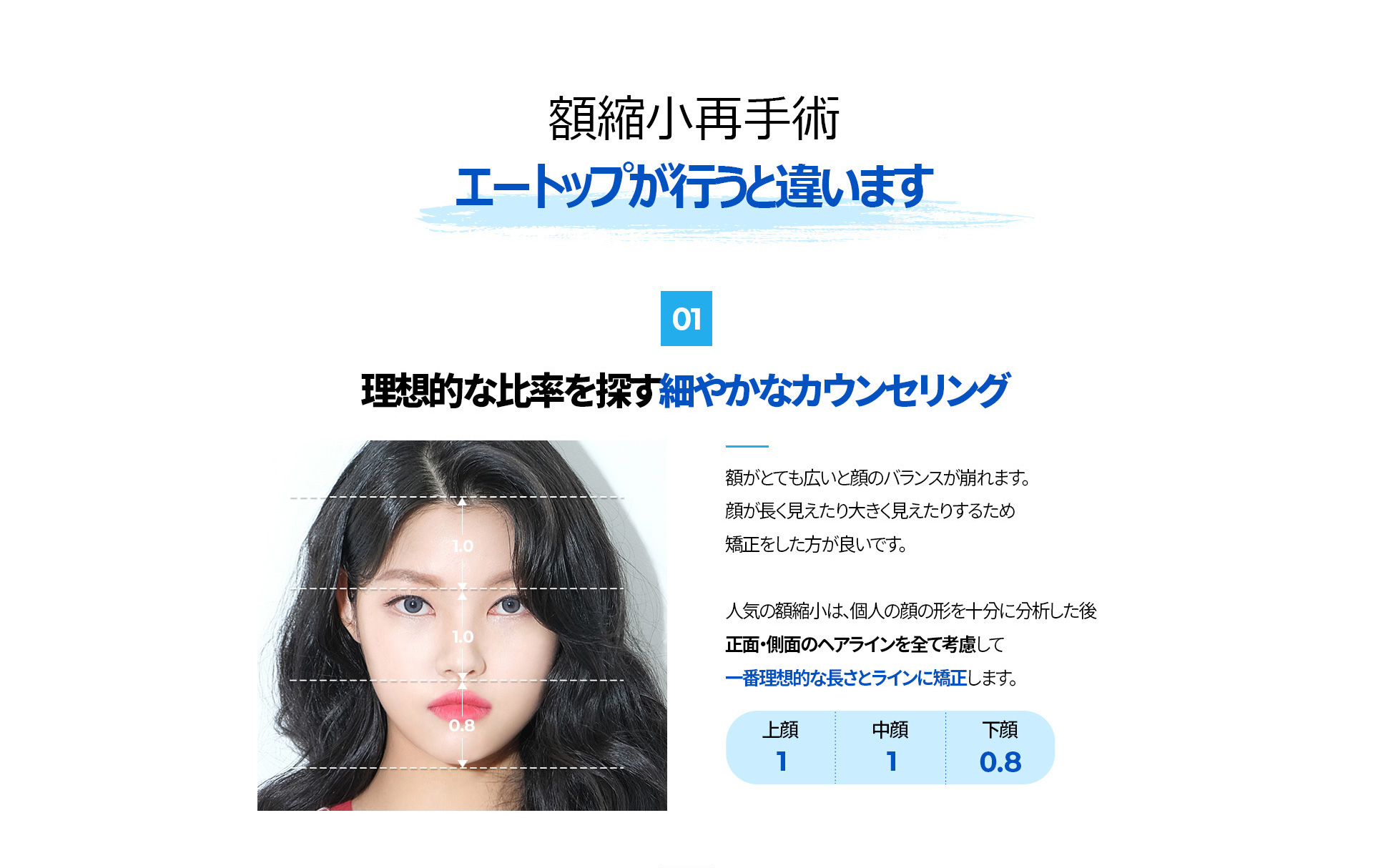 이마축소 재수술