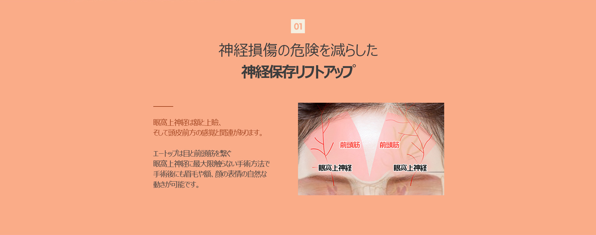 커스텀리프팅