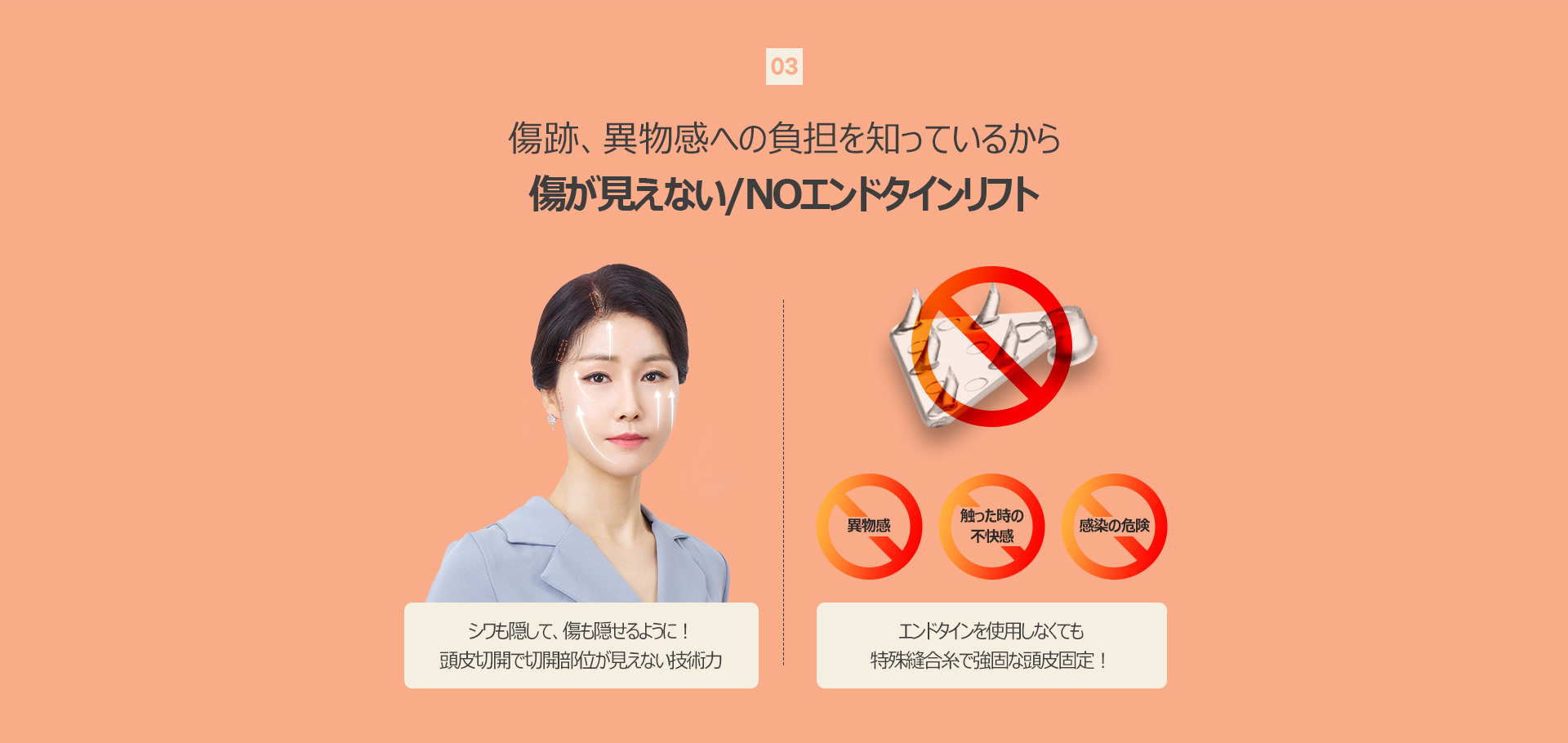 커스텀리프팅