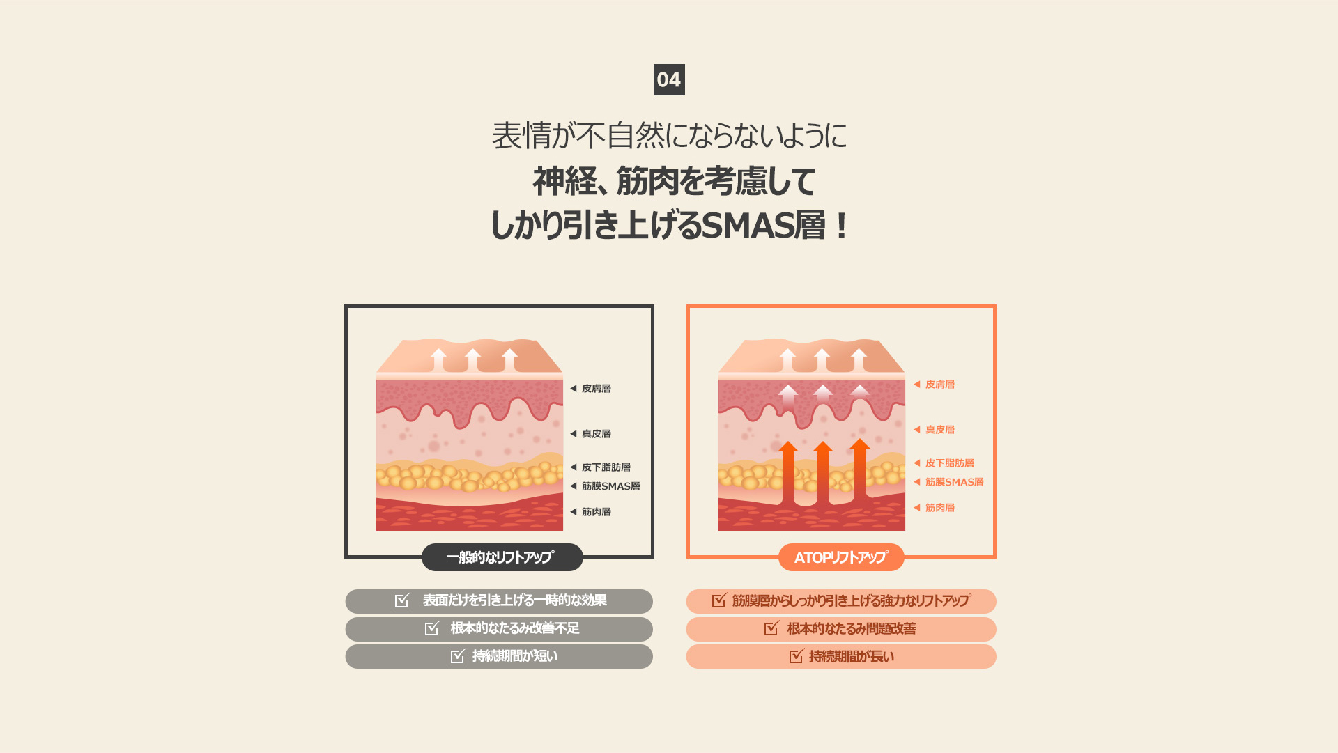 커스텀리프팅