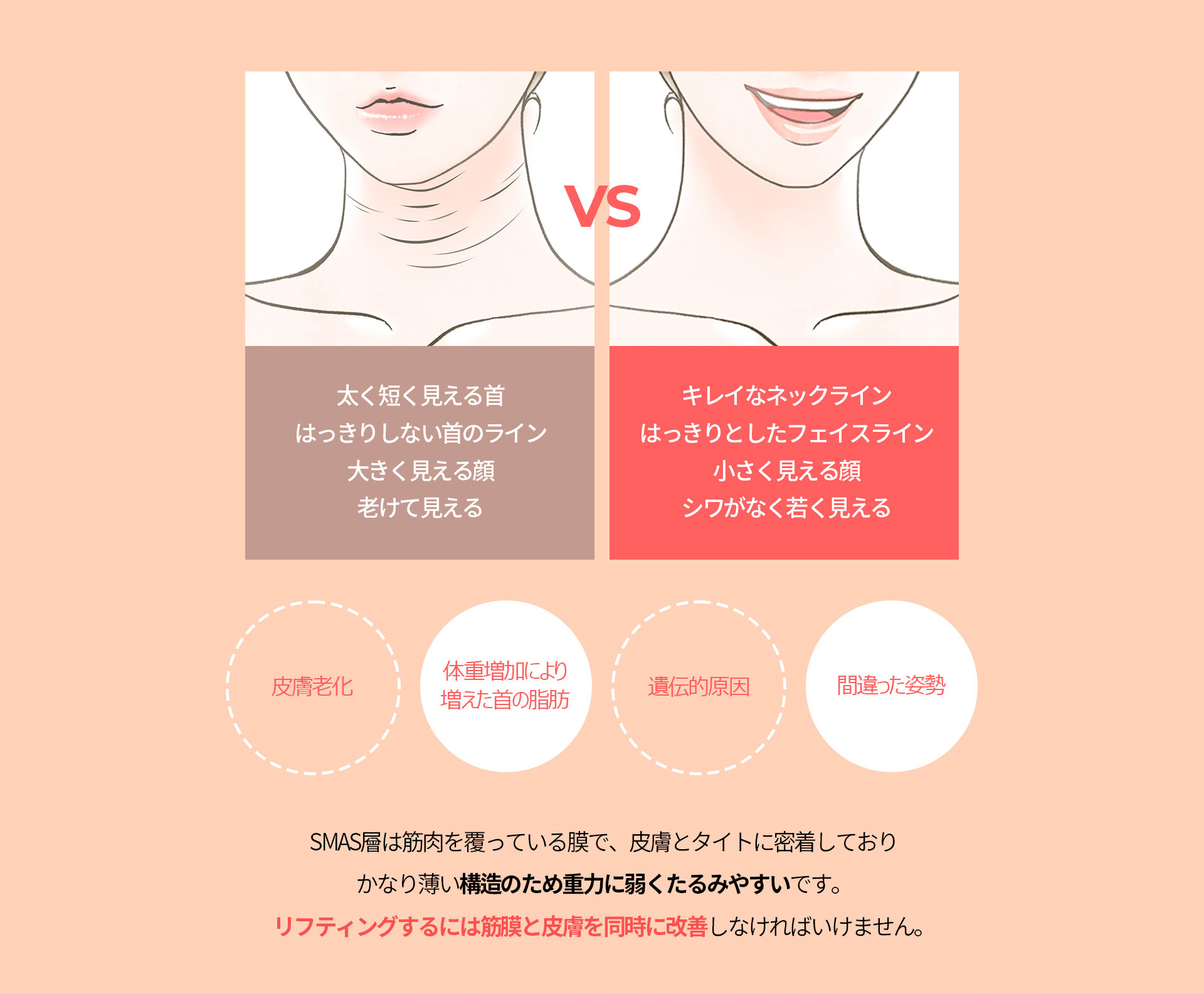 이중턱착붙리프팅