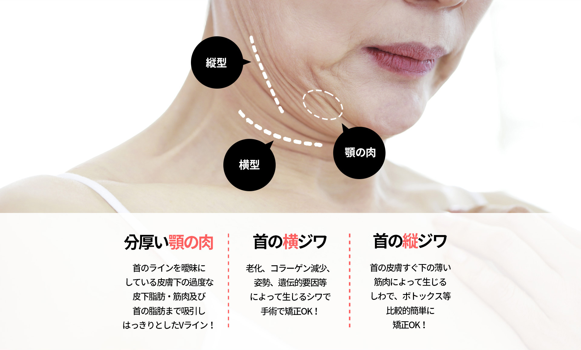 이중턱착붙리프팅