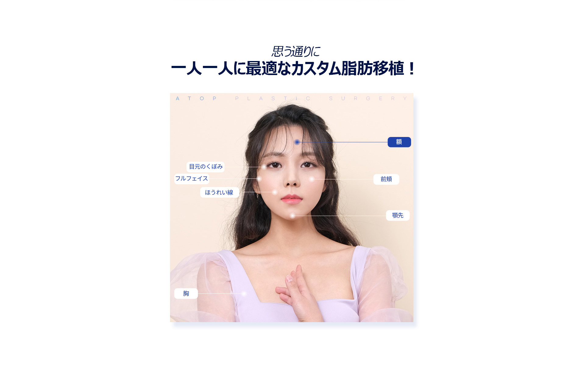 포인트지방이식