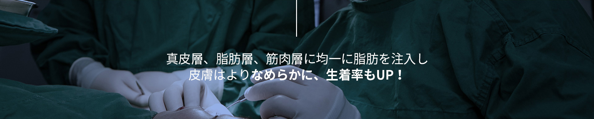 포인트지방이식