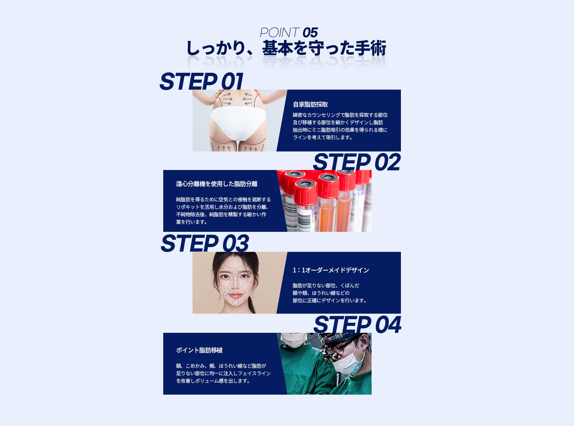 포인트지방이식