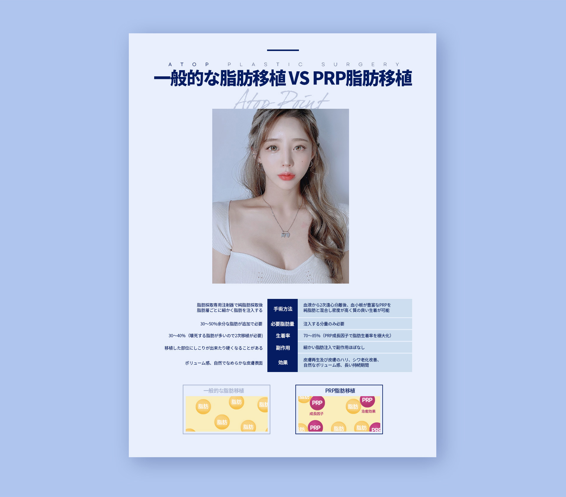 포인트지방이식