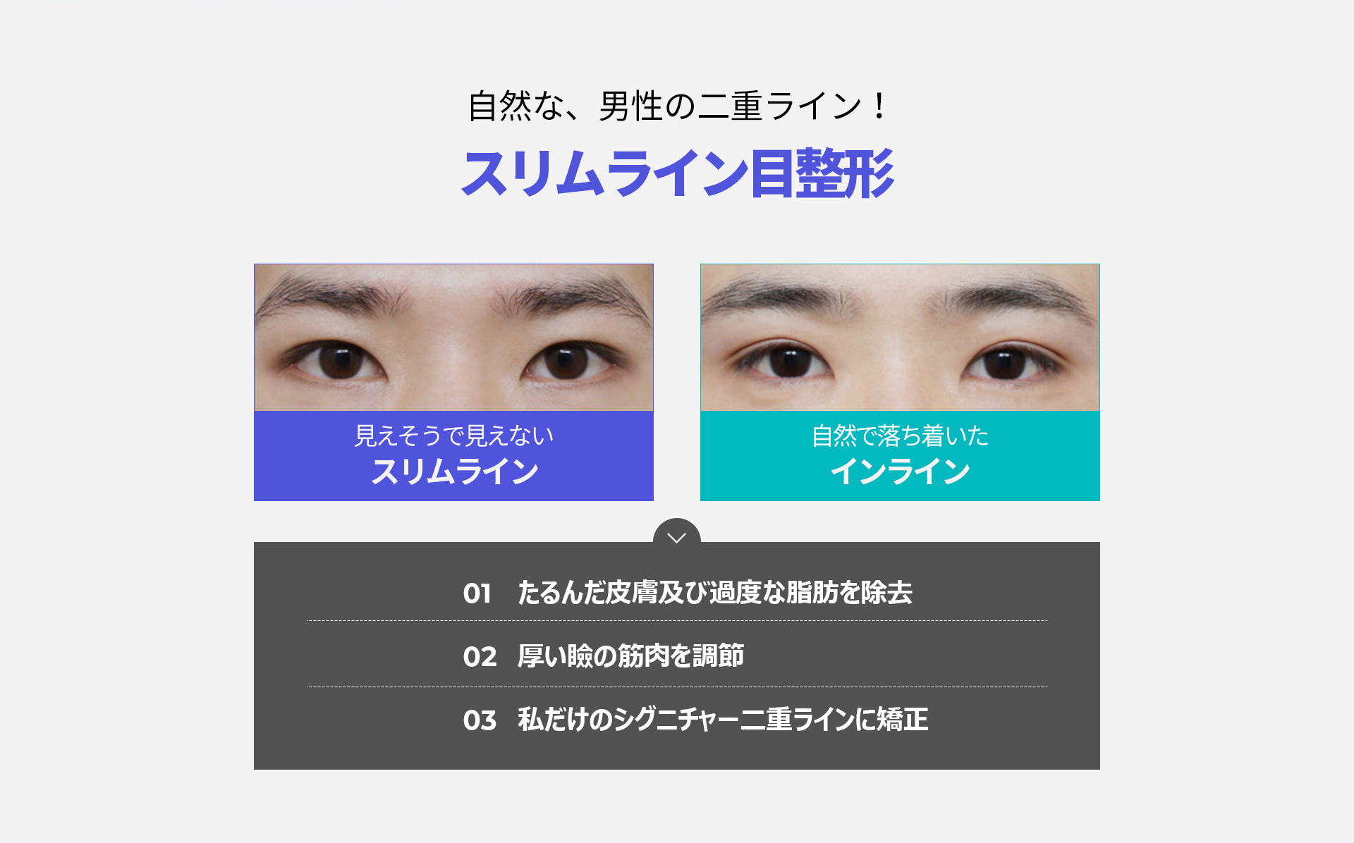 슬림라인 눈성형
