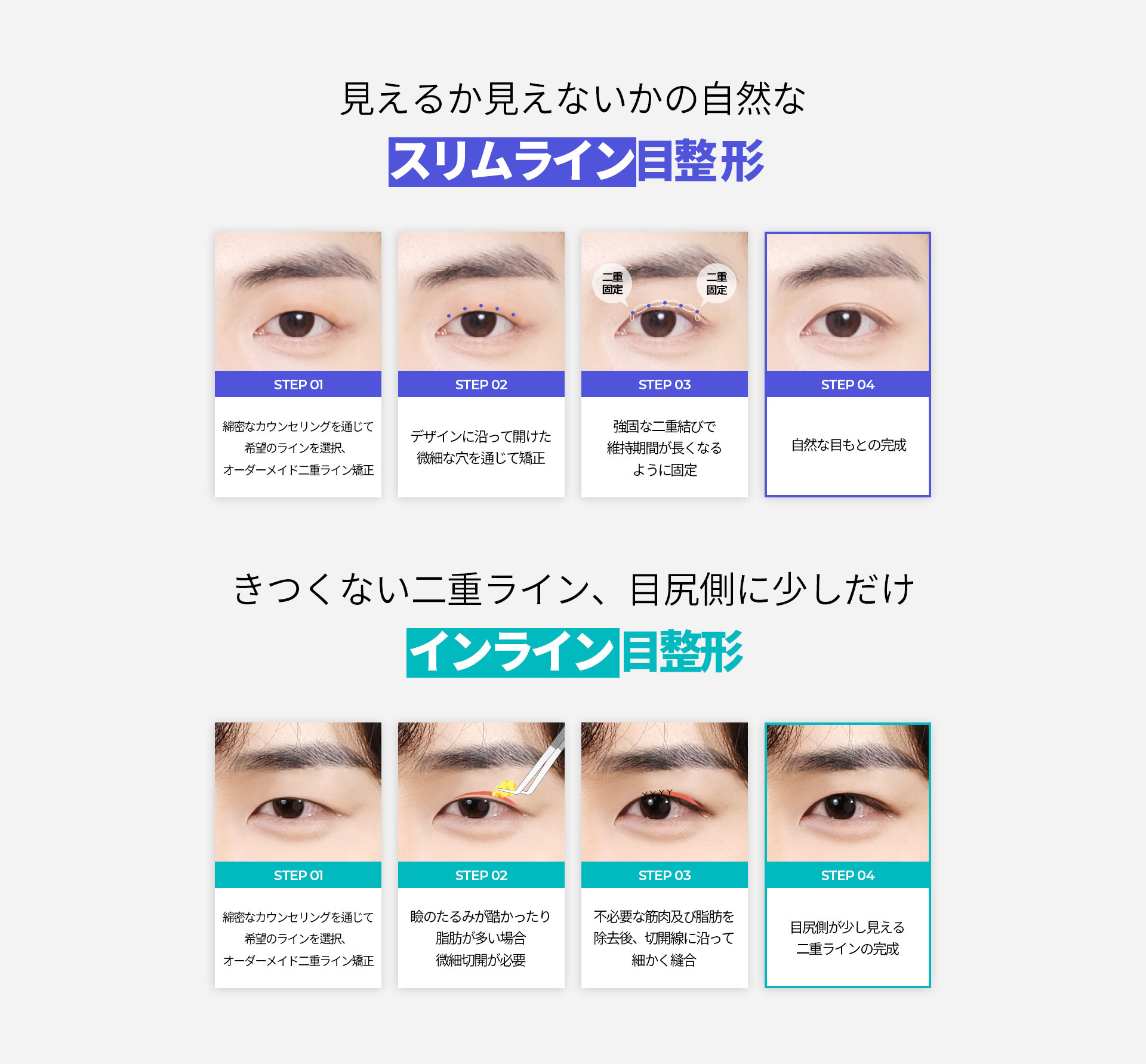 슬림라인 눈성형