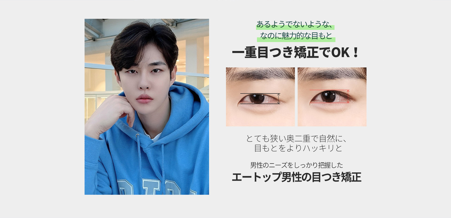 남자 눈매교정