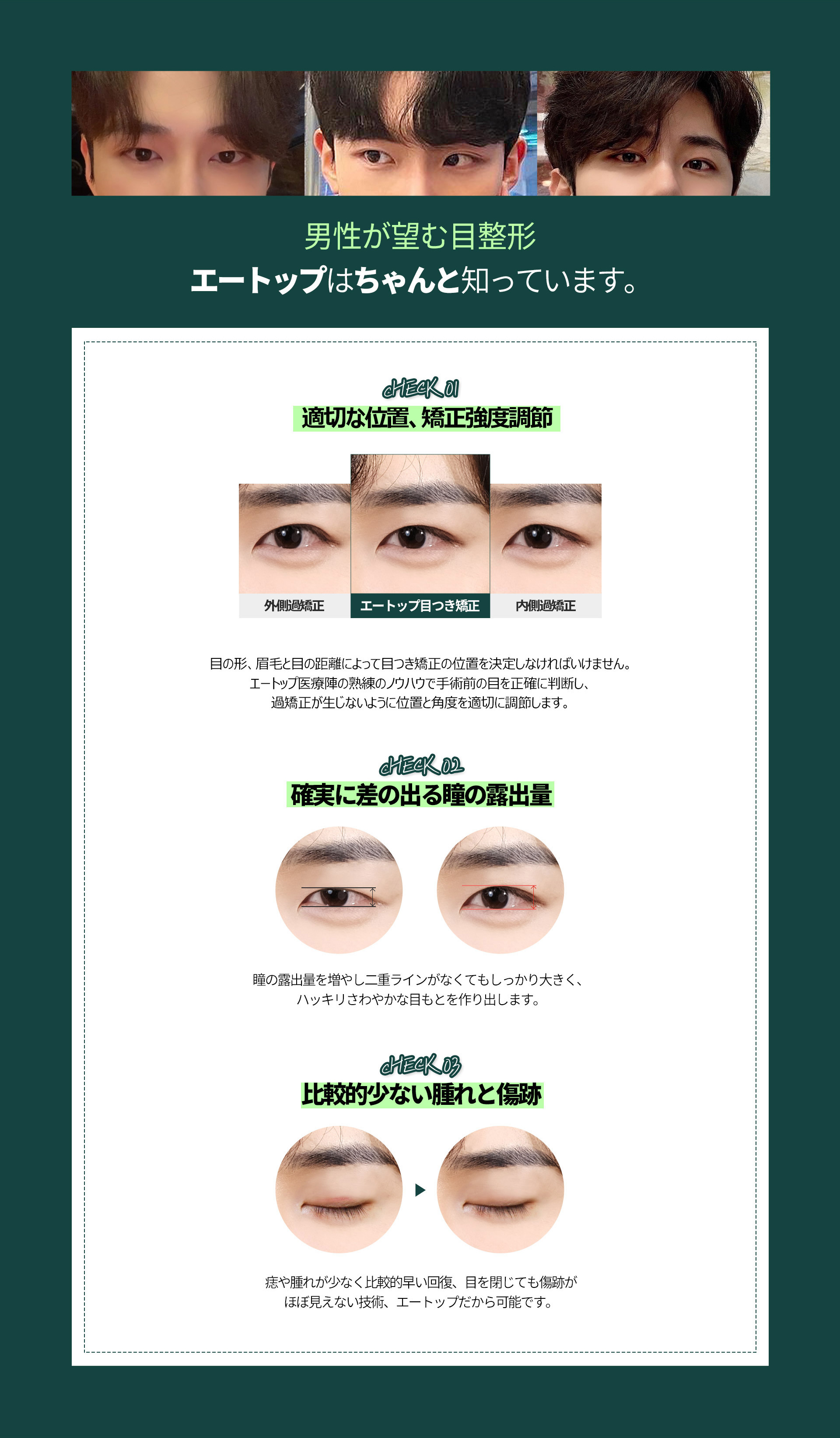 남자 눈매교정