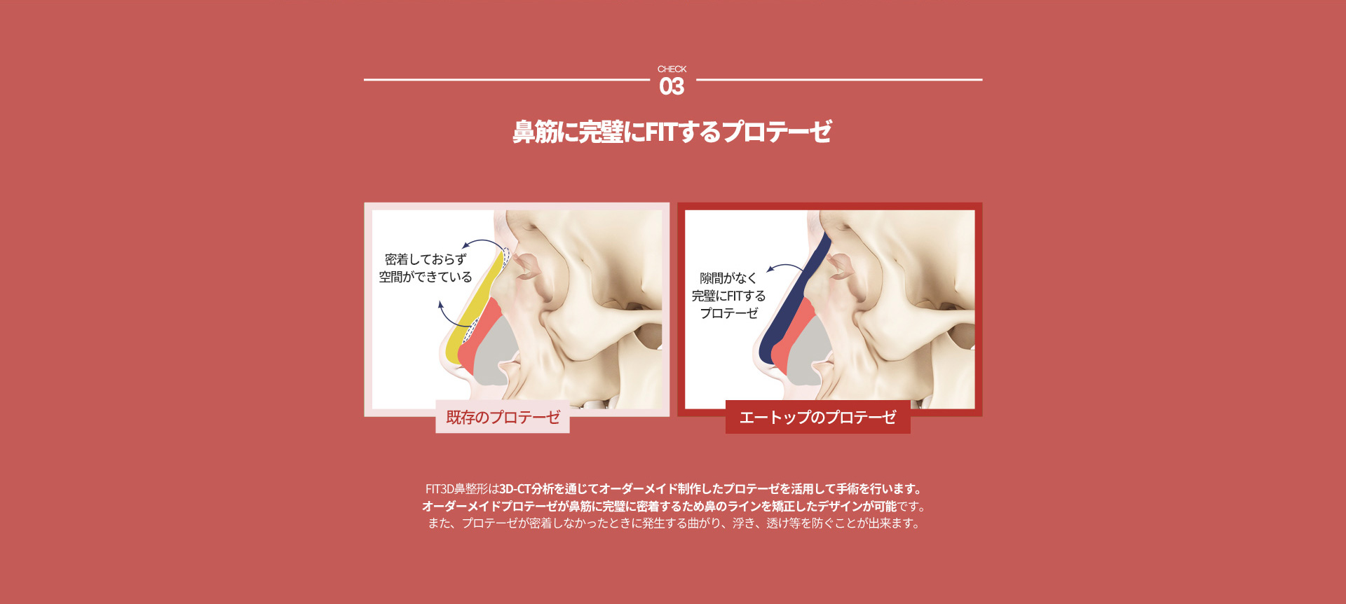 FIT 3D 코성형07