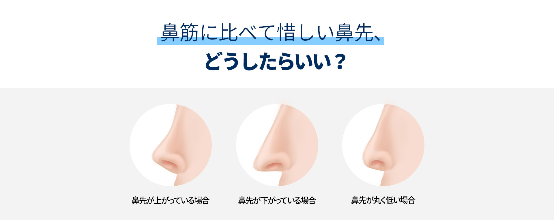 코끝성형