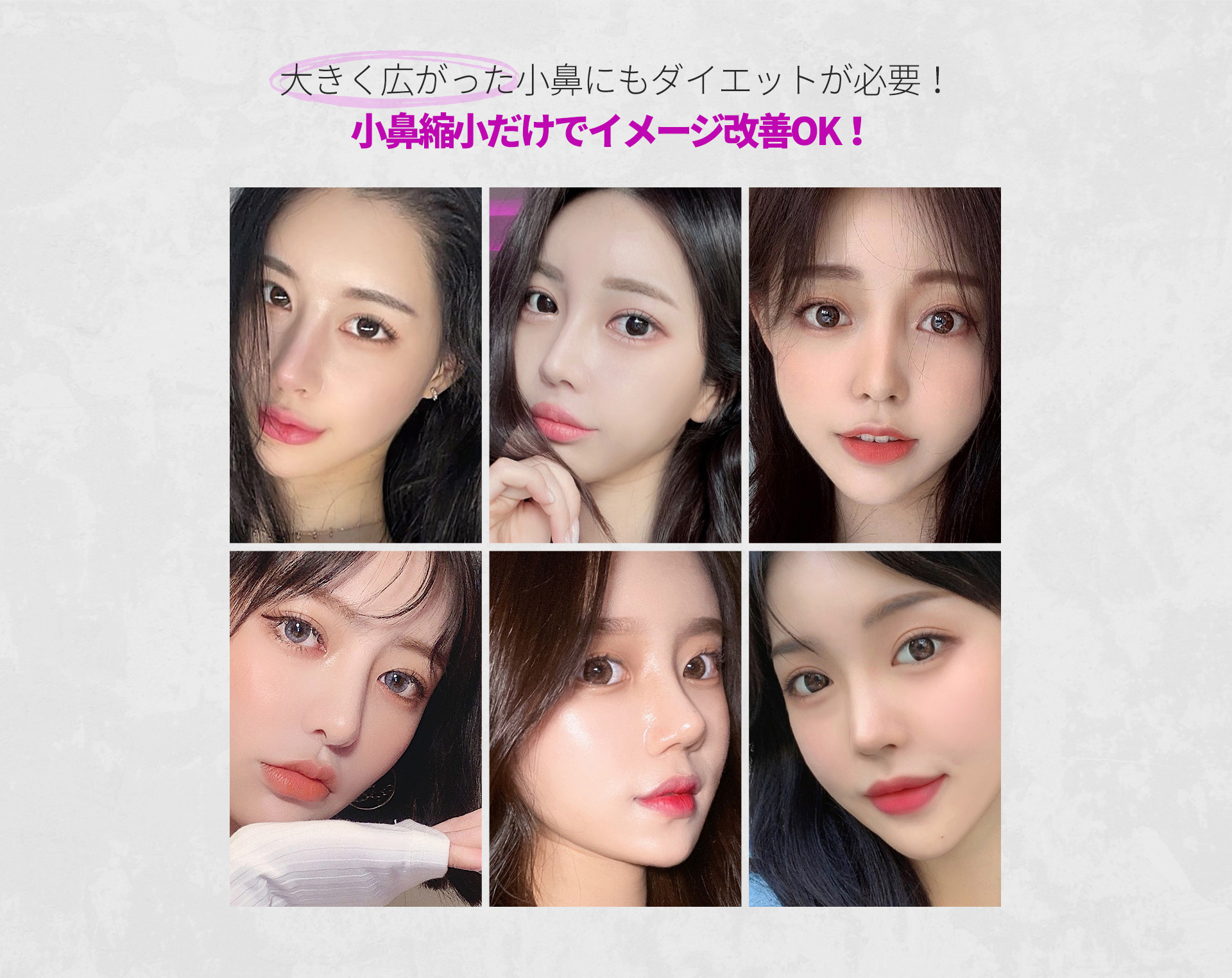 콧볼축소
