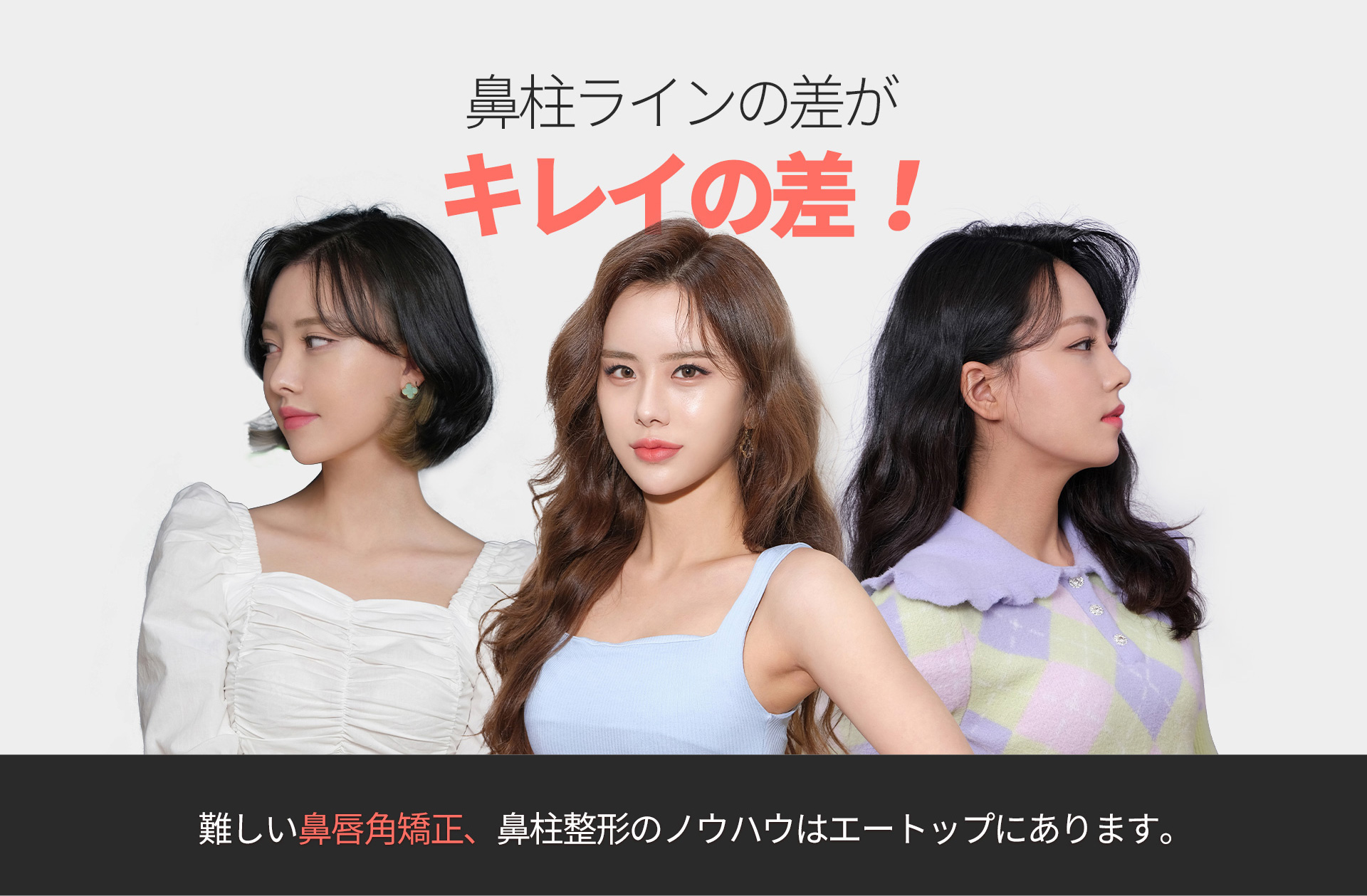 비주성형