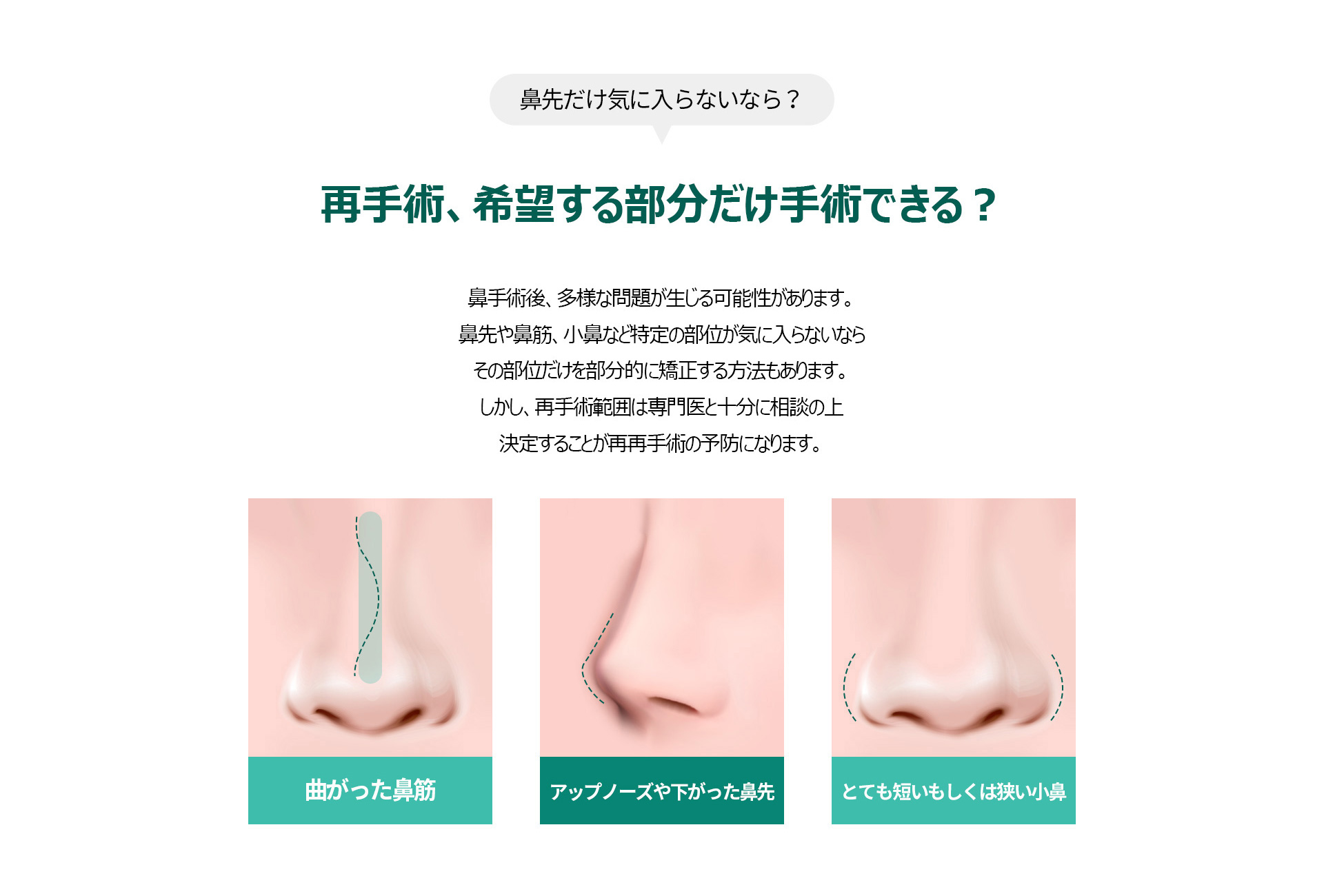 코재수술