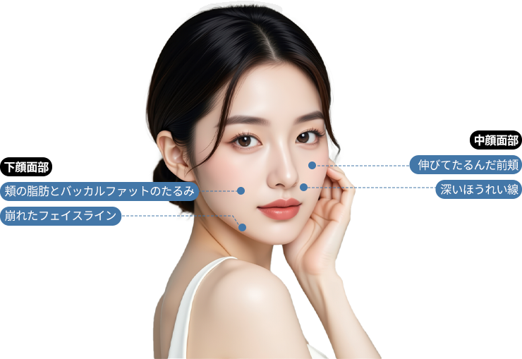 여우리프팅