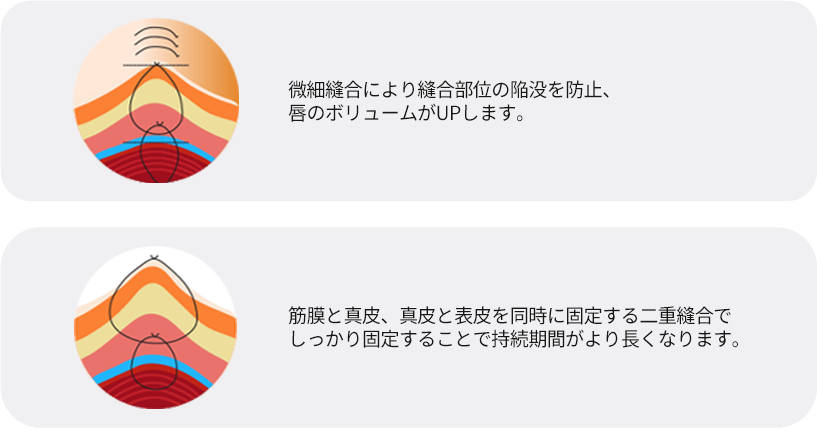인중오목술