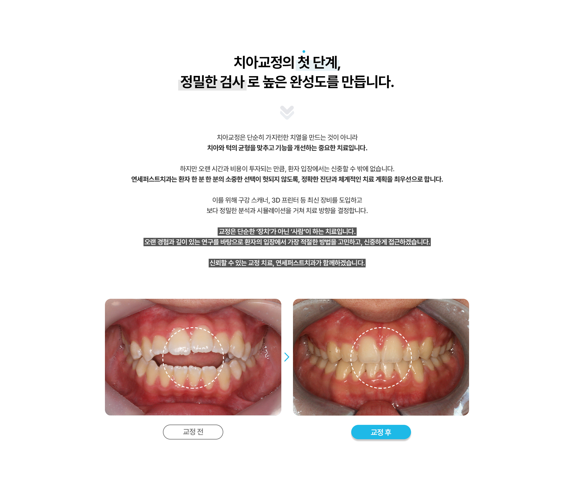 디지털치아교정진단및검사